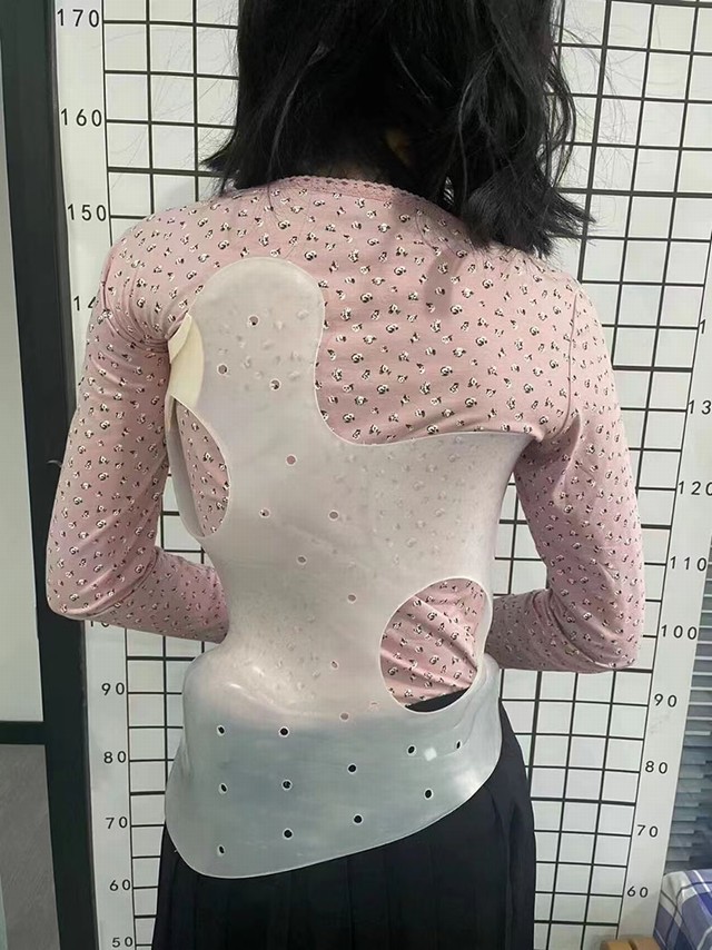 康复实例
