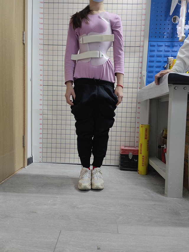 康复实例